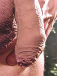 Fantastic Foreskin free picture 1